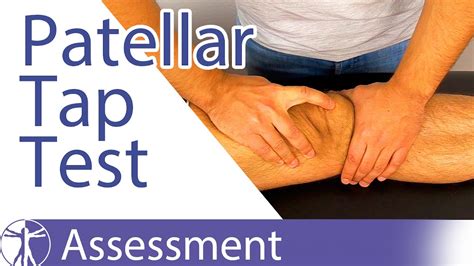 knee cap compression test|patellar compression test positive.